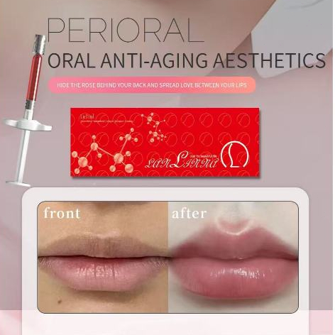 1ml  Filler Bibir  Hyaluronic Acid