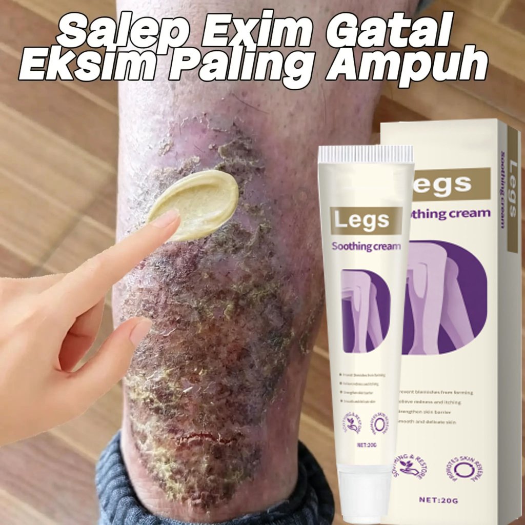 Legs Soothing Cream untuk gatal kulit Salep Gatal Paling Ampuh Obat Gatal Selangkangan Salep Bayi Un