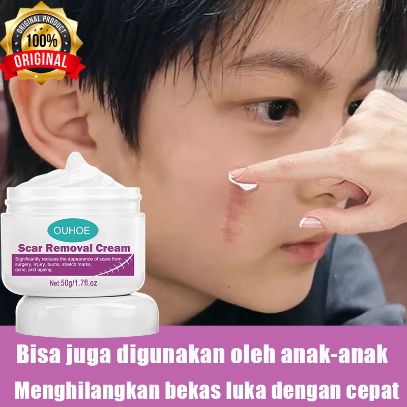 Scar Removal Cream - Penghilang Bekas Luka Krim Ampuh ORIGINAL 100%