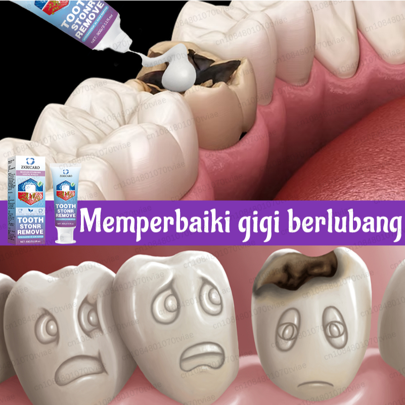 Pasta gigi anti-lubang untuk orang dewasa! Memperbaiki kerusakan gigi dalam 7 hari - Teknologi nano-