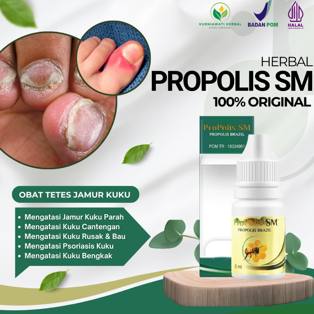 Obat Tetes Jamur Kuku, Cantengan Jempol Kaki,  Psoriasis Kuku, Kuku Rusak, Kuku Bau Busuk, Kuku Cant