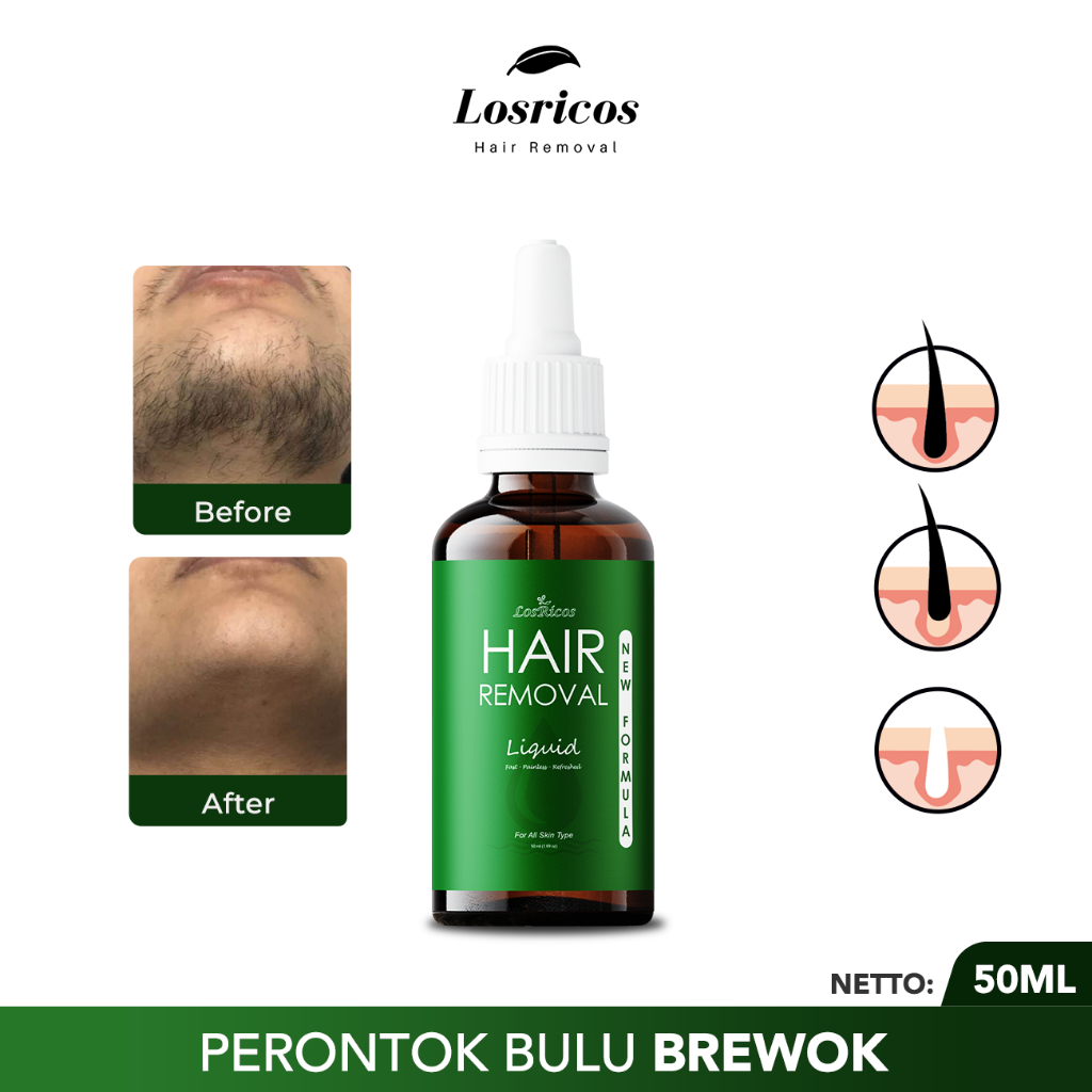 Perontok Bulu Rambut Brewok BPOM  Losricos Hair Removal liquid 50ml Penghilang Bulu Jenggot &Kumis