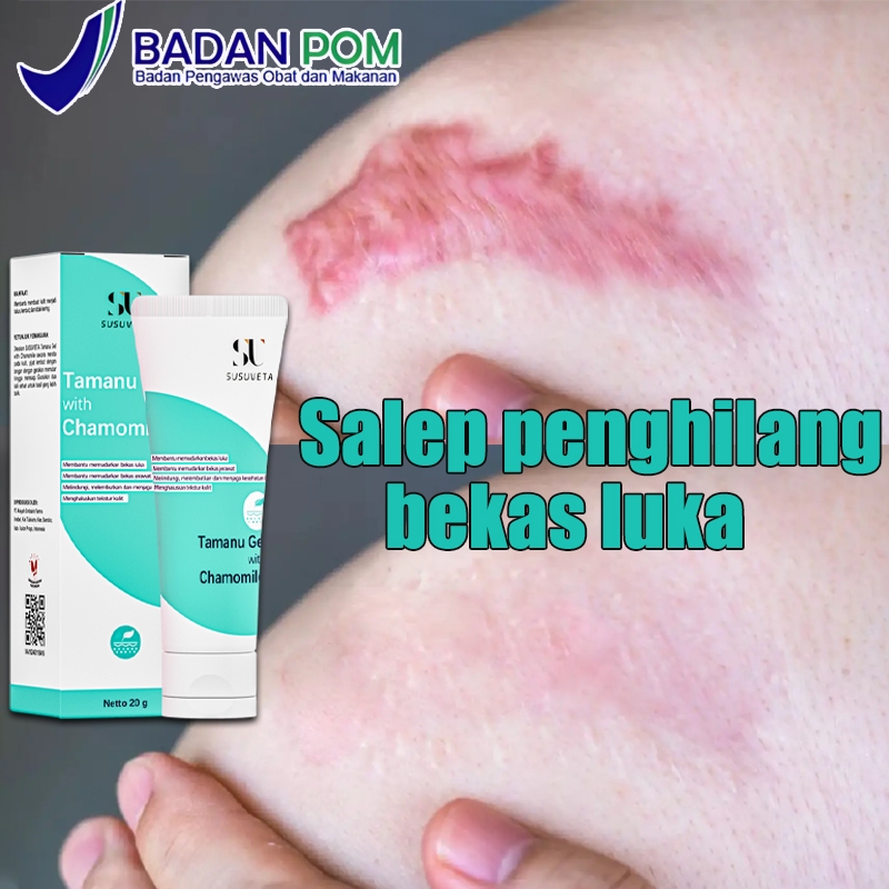 Salep penghilang bekas luka Penghilang bekas luka hitam koreng Penghilang bekas luka anak 20g cream 