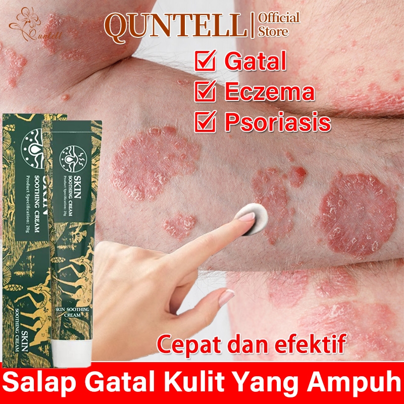 Salap Gatal Kulit Yang Ampuh Obat Gatal Kulit Salep Gatal Paling Ampuh Obat Gatal Selangkangan Dan H