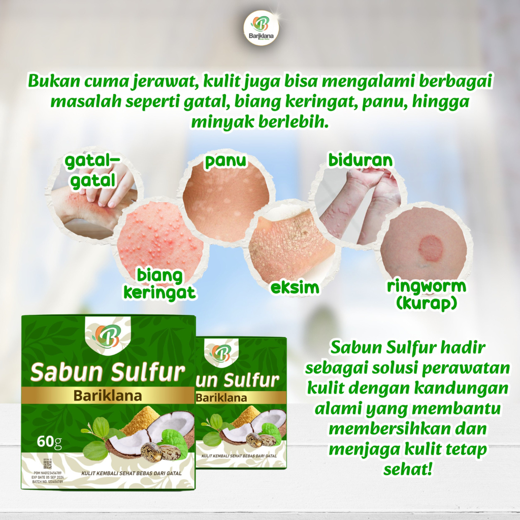 Sabun Sulfur Obat Budug Seluruh Badan Gatal Penghilang Korengan Scabies Manusia Skabies Babak Gudik 
