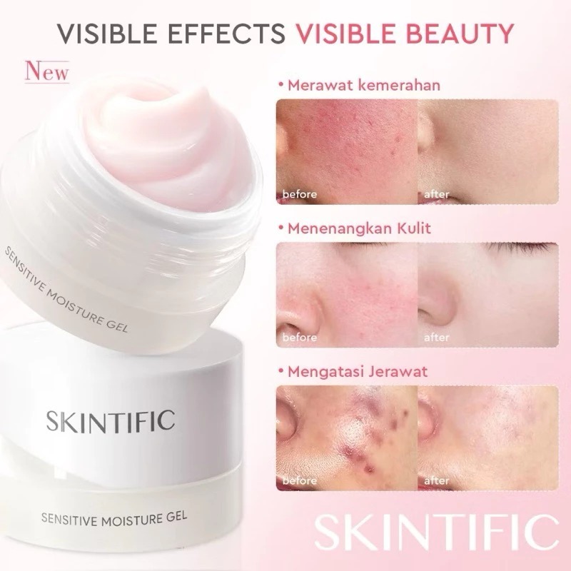 MOISTURIZER GEL SKINTIFIC