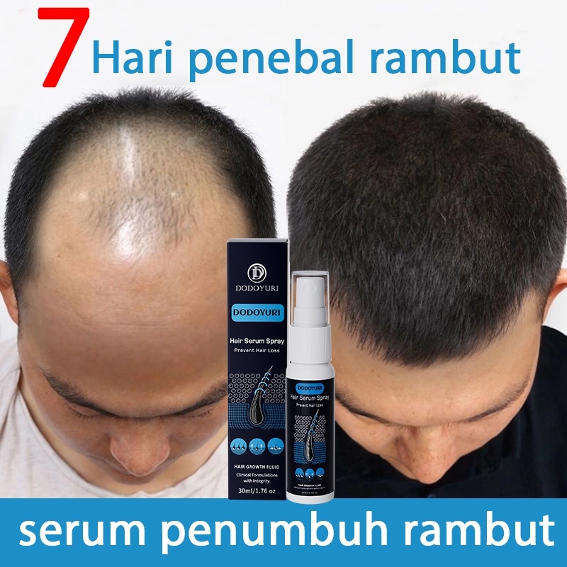 【BPOM】Serum penumbuh rambut penumbuh rambut botak penebal rambut penumbuh rambut cepat 30ml hair ton