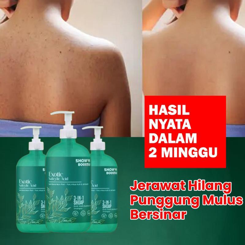 Leeva Sabun Exotic Acne 250ml - Sabun Mandi Kulit Sensitif, Mengatasi Jerawat & Panu, Melembabkan Ku