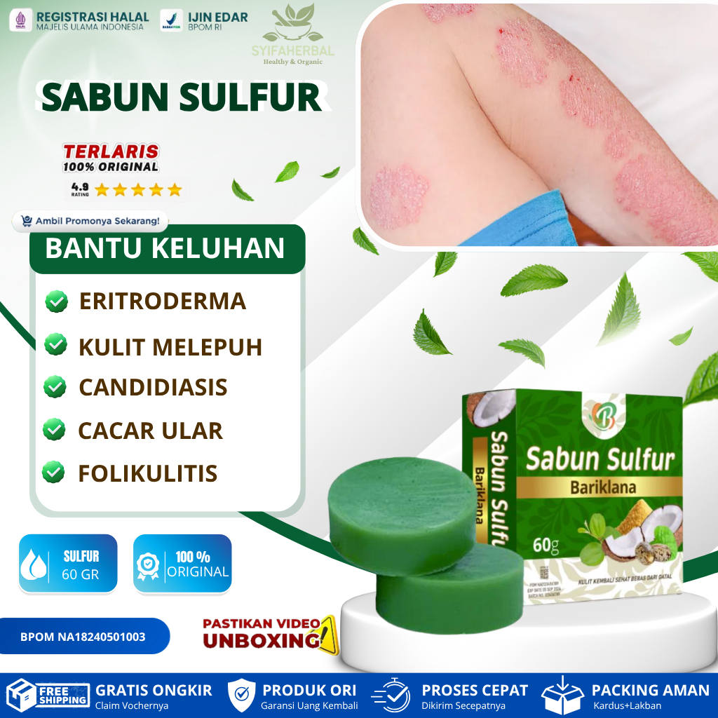 Sabun Sulfur - Sabun Gatal Selangkangan Sabun Gatel Sabun Gatal Paling Ampuh Sabun Kurap 60g Sabun G