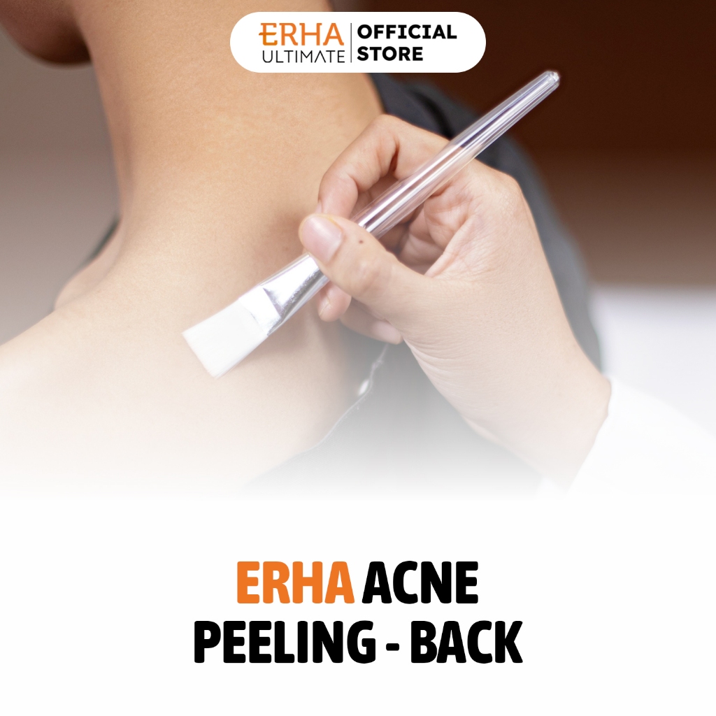 ERHA Acne Peeling Back - Treatment Jerawat Badan