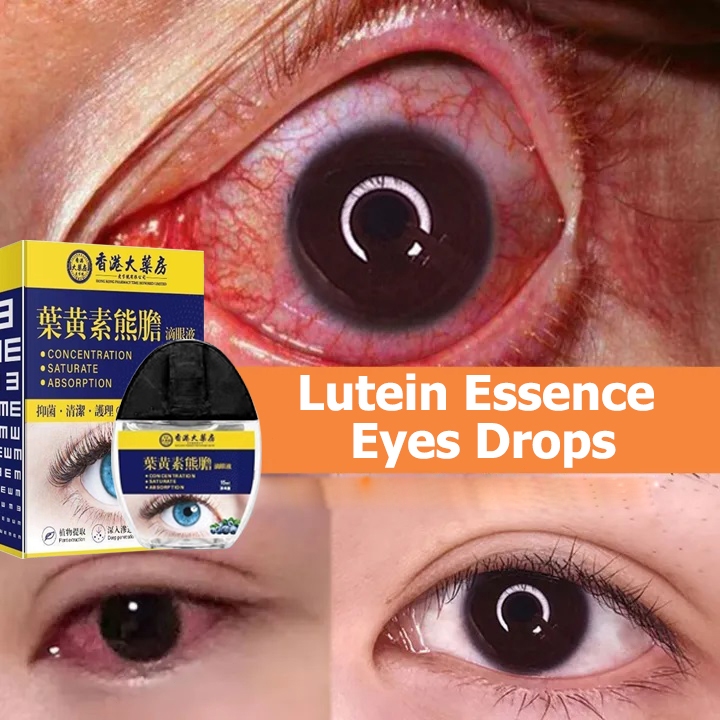 Obat MataTetes Mata Permata Original Mengatasi Masalah pada mata Penyesuaian minus dan plus pada pen