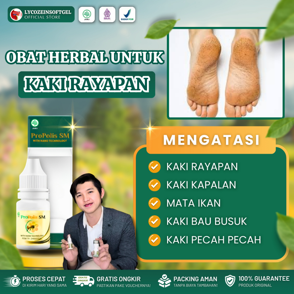 Obat Kaki Rayapan Telapak kaki Bolong Korodok Kutu Air Kaki Rayapan Berlubang Dan Bau