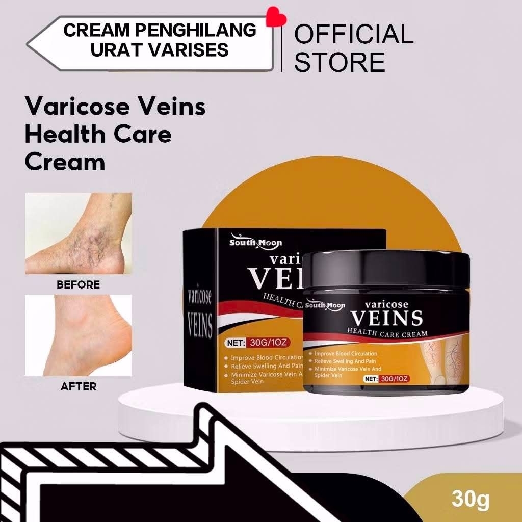 CREAM PENGHILANG URAT VARISES DI TUBUH