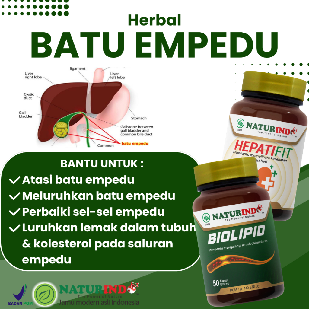 Herbal Peluruh Batu Empedu Ampuh Atasi Batu Empedu Tanpa Operasi Penghancur Batu Empedu