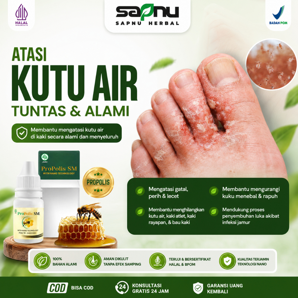 Obat Kutu Air, Penghilang Kuman Air, Gatal Berair, Kutu Air Pada Kaki, Jamur Kaki, Kutu Air Pada Sel