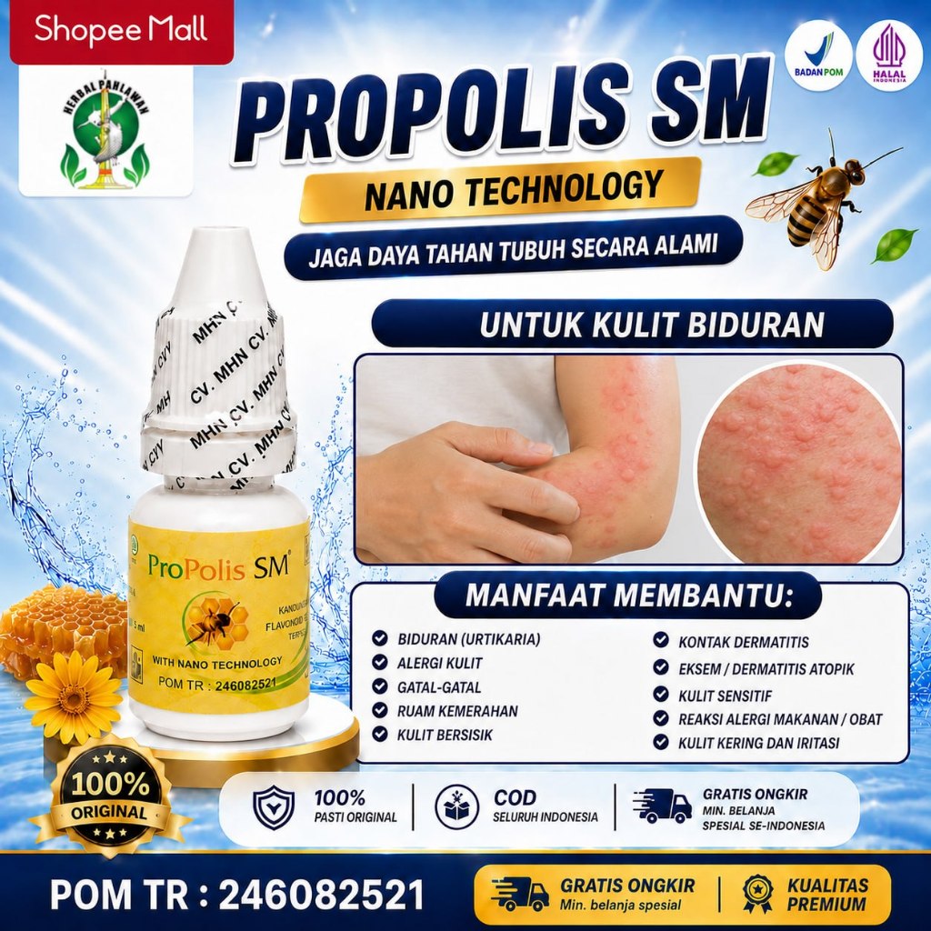 Obat Untuk Kulit Biduran, Alergi Kulit, Gatal Gatal - Propolis SM BPOM
