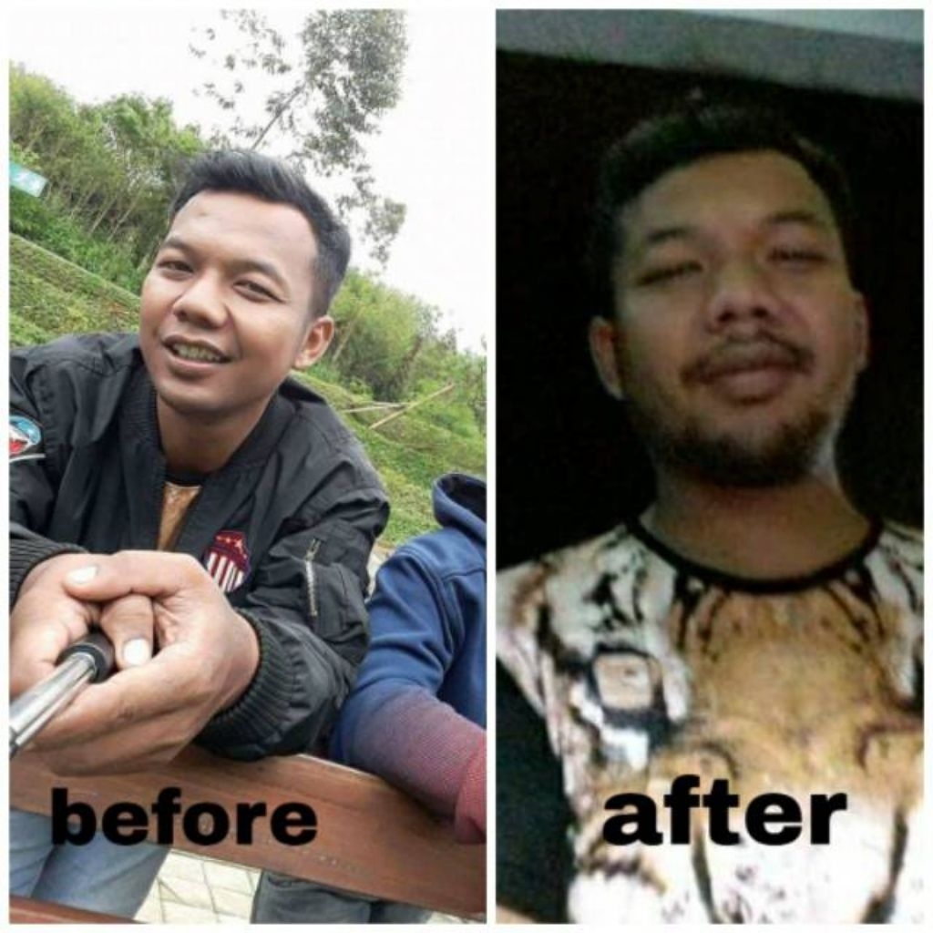 Penumbuh Brewok