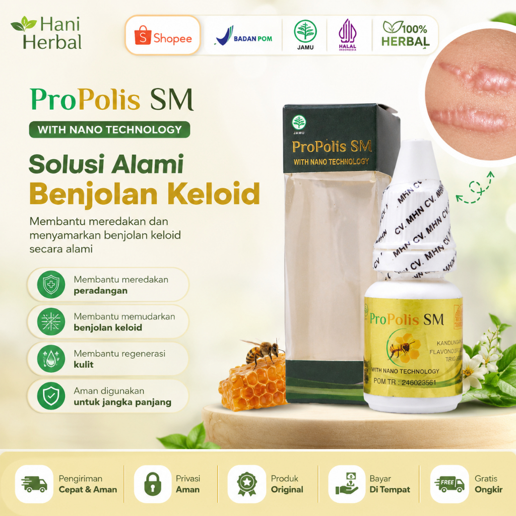 Propolis SM Asli untuk Gatal Benjolan Keloid | Suplemen Propolis Herbal Original