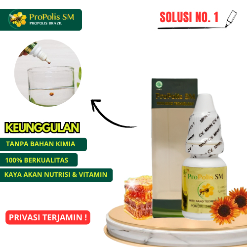 Obat Borok Kepala - Infeksi Jamur Kulit Kepala - Tinea Capitis - Korengan Propolis Brazilian SM