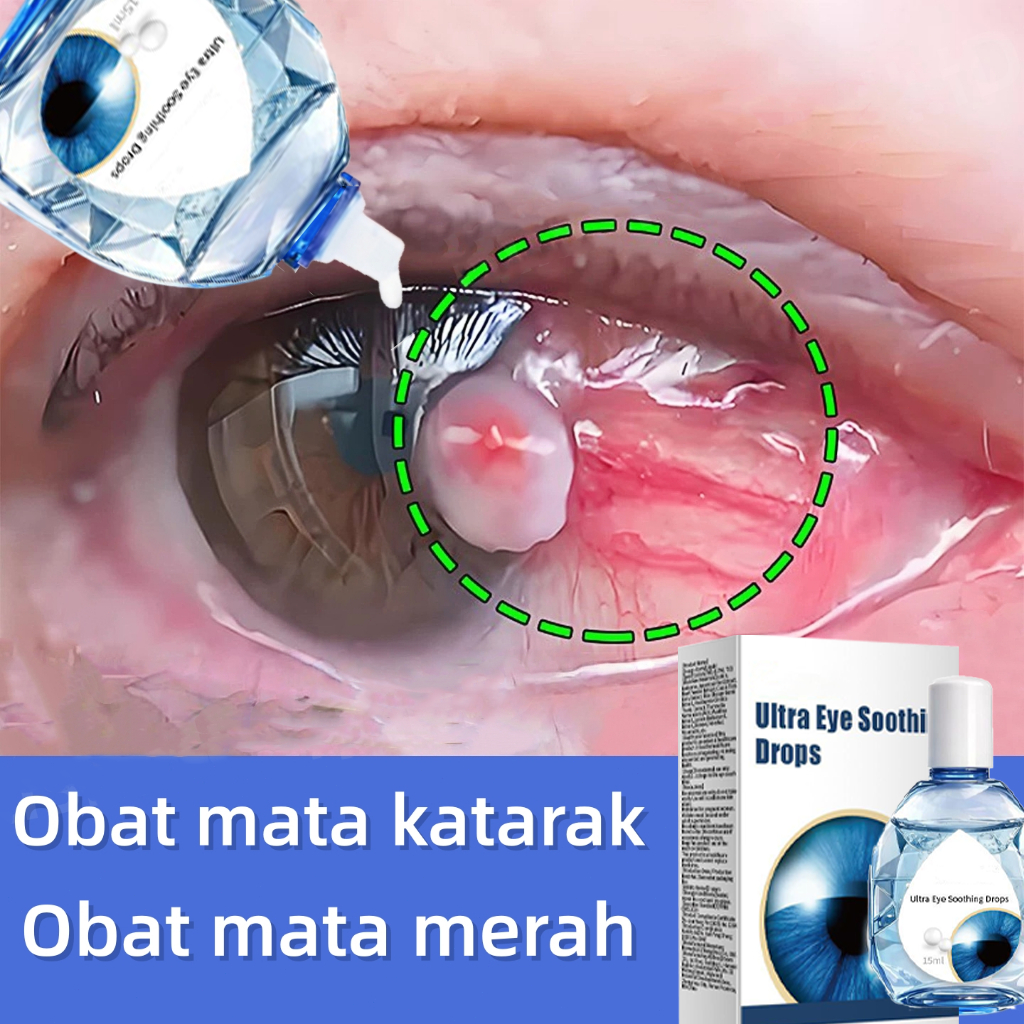 Tetes Mata Mata Katarak Tetes Mata untuk Penglihatan Kabur Astigmatisme Miopia Eye Drop Tetes Mata K