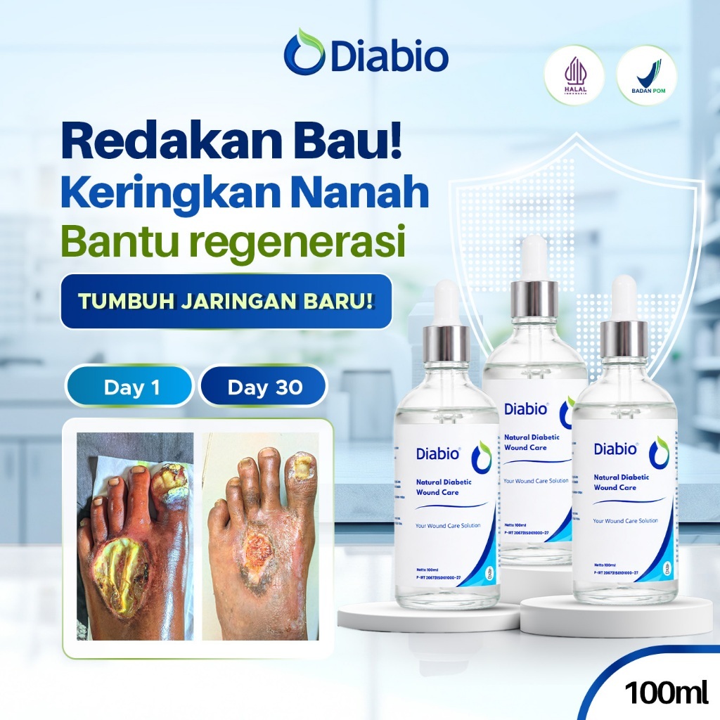 DIABIO Obat Luka Diabetes | luka cepat kering luka diabetes obat baring kering | gula kaki bernanah