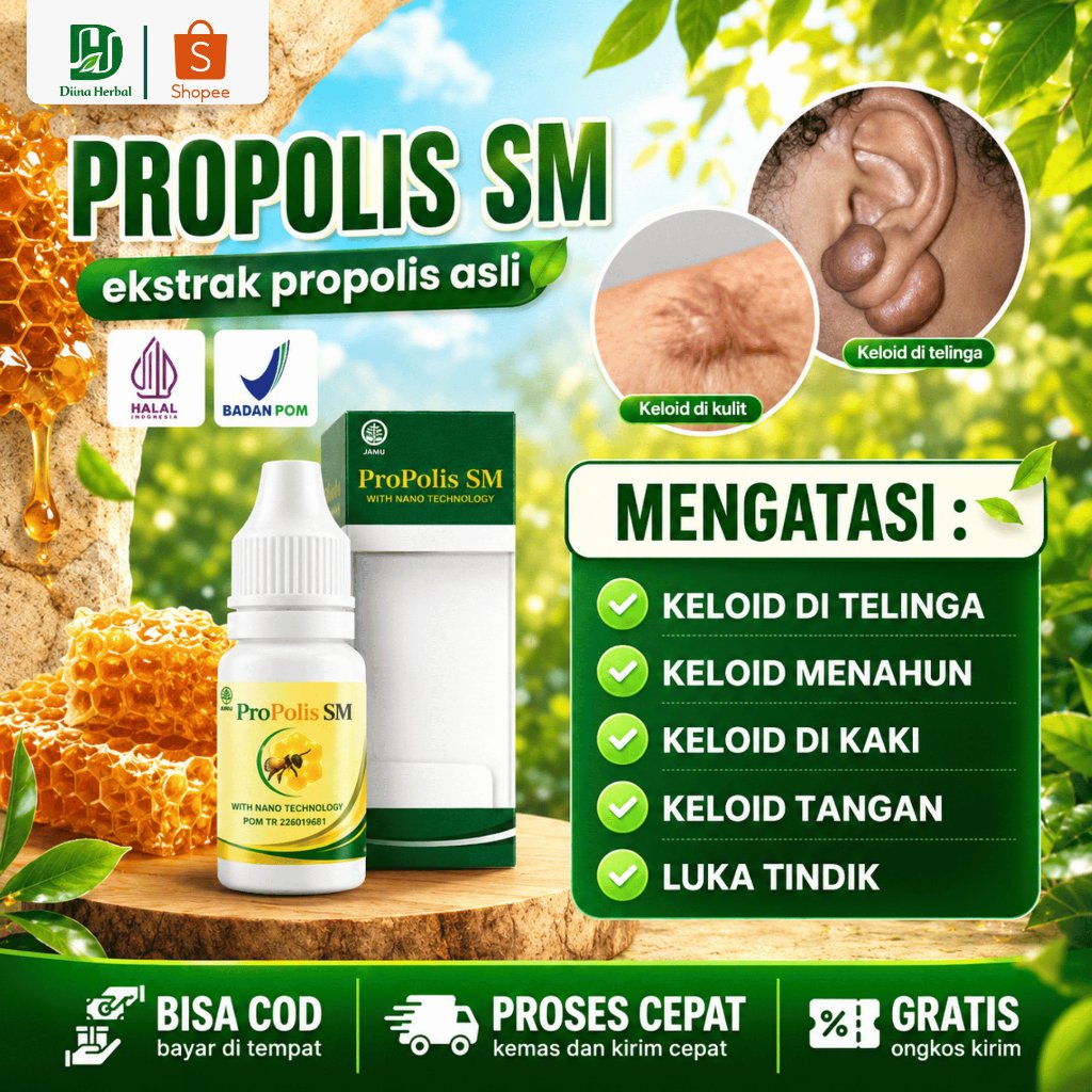 Obat Pengempis Keloid, Keloid Menahun, Luka Tindik, Keloid di Perut, Keloid di Telinga, Keloid Dagin