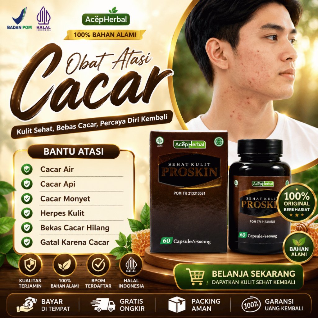 Obat Cacar Air Cacar Api Penghilang Bekas Cacar Cacar Monyet Cacar Bintik Bintik Merah Berair Cacar 