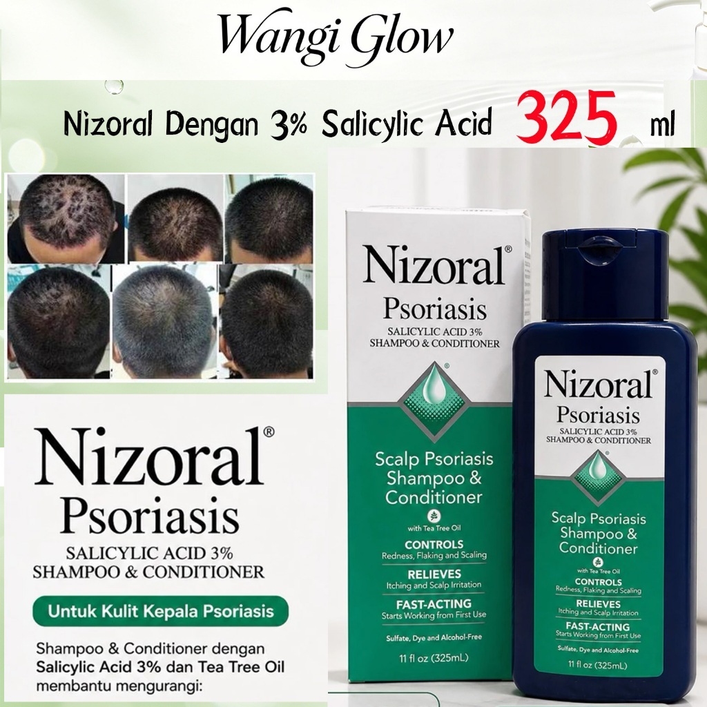 Nizoral Shampoo Psoriasis Kulit Kepala 325ml