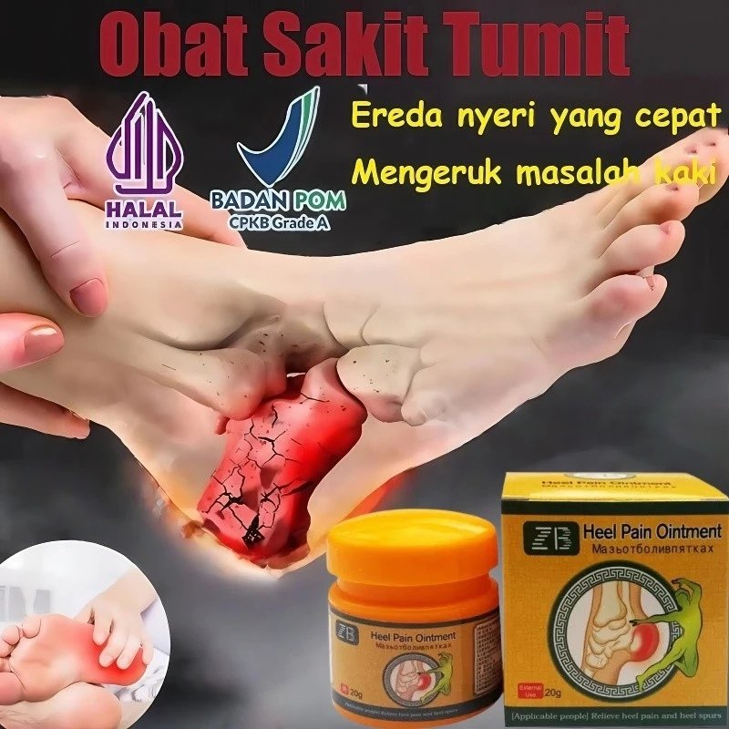 20g Obat Sakit Tumit Krim Pijat Kaki kaki fasciitis terapi Terapi kaki pereda nyeri heel pain relief