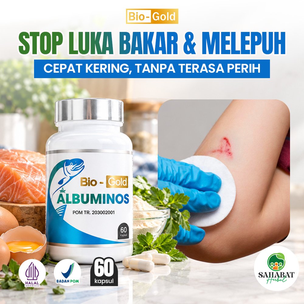 OBAT LUKA BAKAR PALING AMPUH Albuminos Kapsul Kutuk Penyembuh Pengering Luka Bakar Luka Diabetes