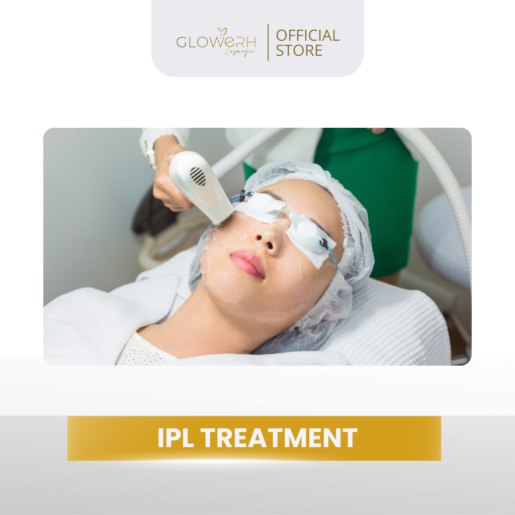 Glowerh IPL Treatment