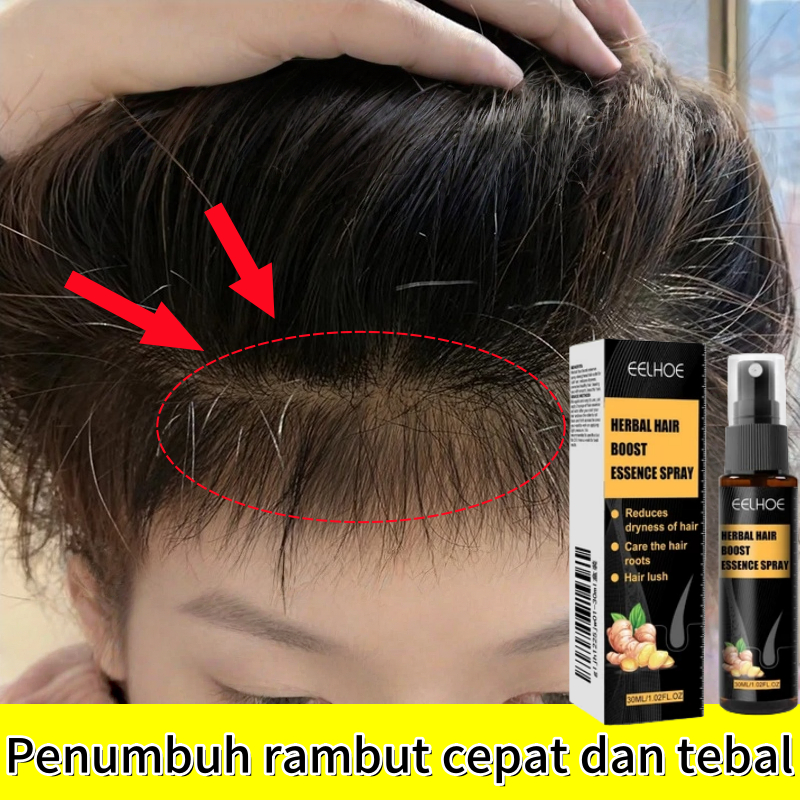 Penumbuh rambut Obat rambut rontok Penumbuh rambut cepat dan tebal Penebal Rambut Cepat Anti Rontok 