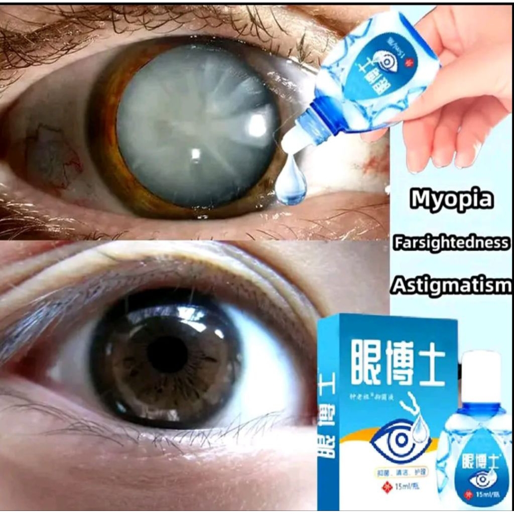 Original 100% Herbal Obat Tetes Mata Jepang Obat Tetes Mata Katarak Mata Gatal Mata Merah Mata Minus