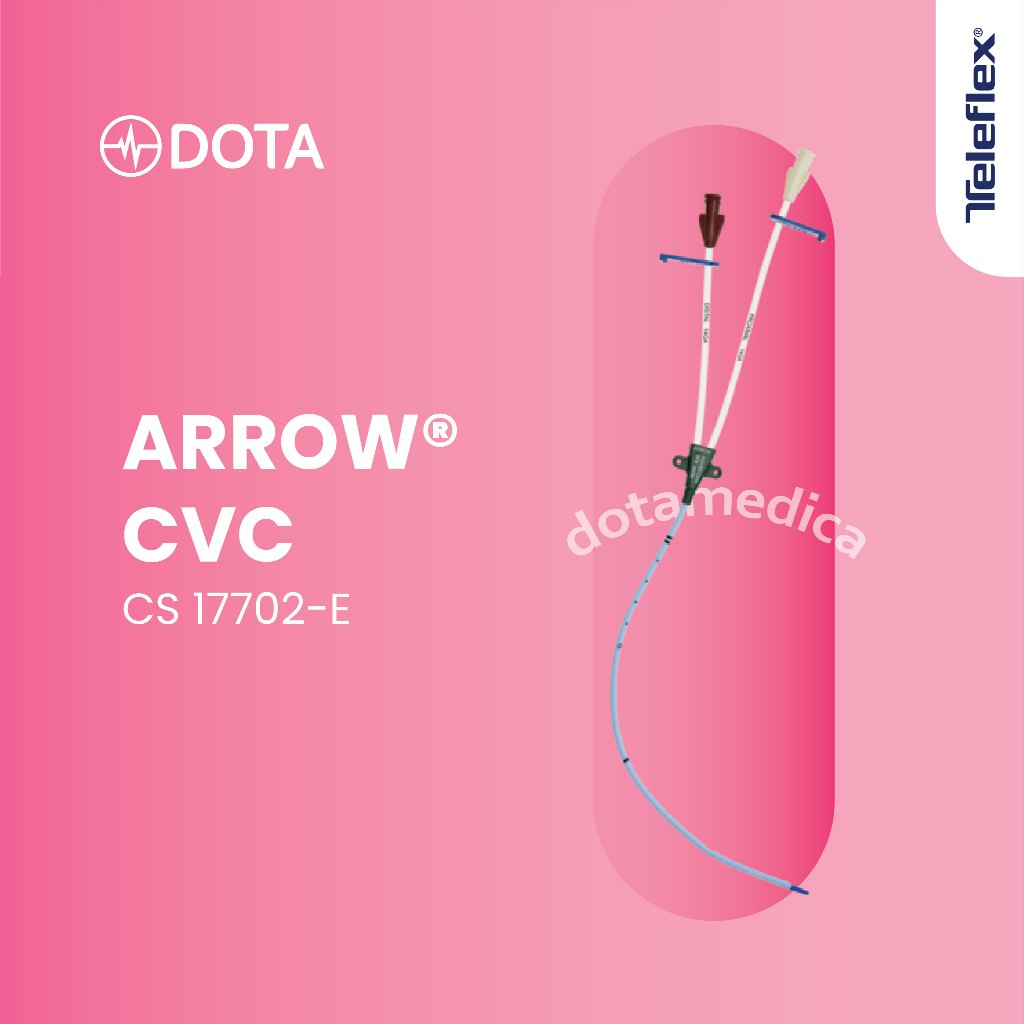 ARROW Central Venous Catheter (CVC Set) Double Lumen 7FR x 20cm CS-17702-E