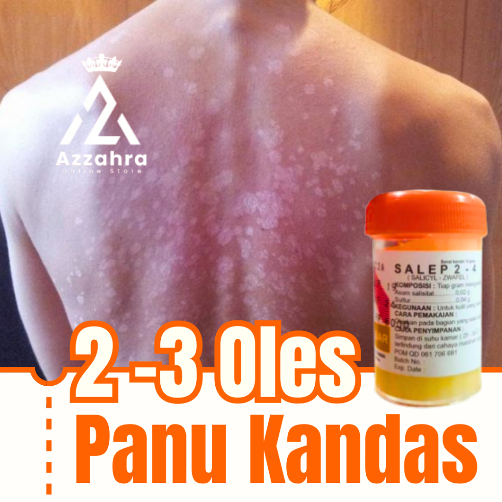 Obat Panu Paling Ampuh 0bat Krim Gatal Kurap Jamur Kulit Eksim Herpes Salep 24 Original 100% Asli