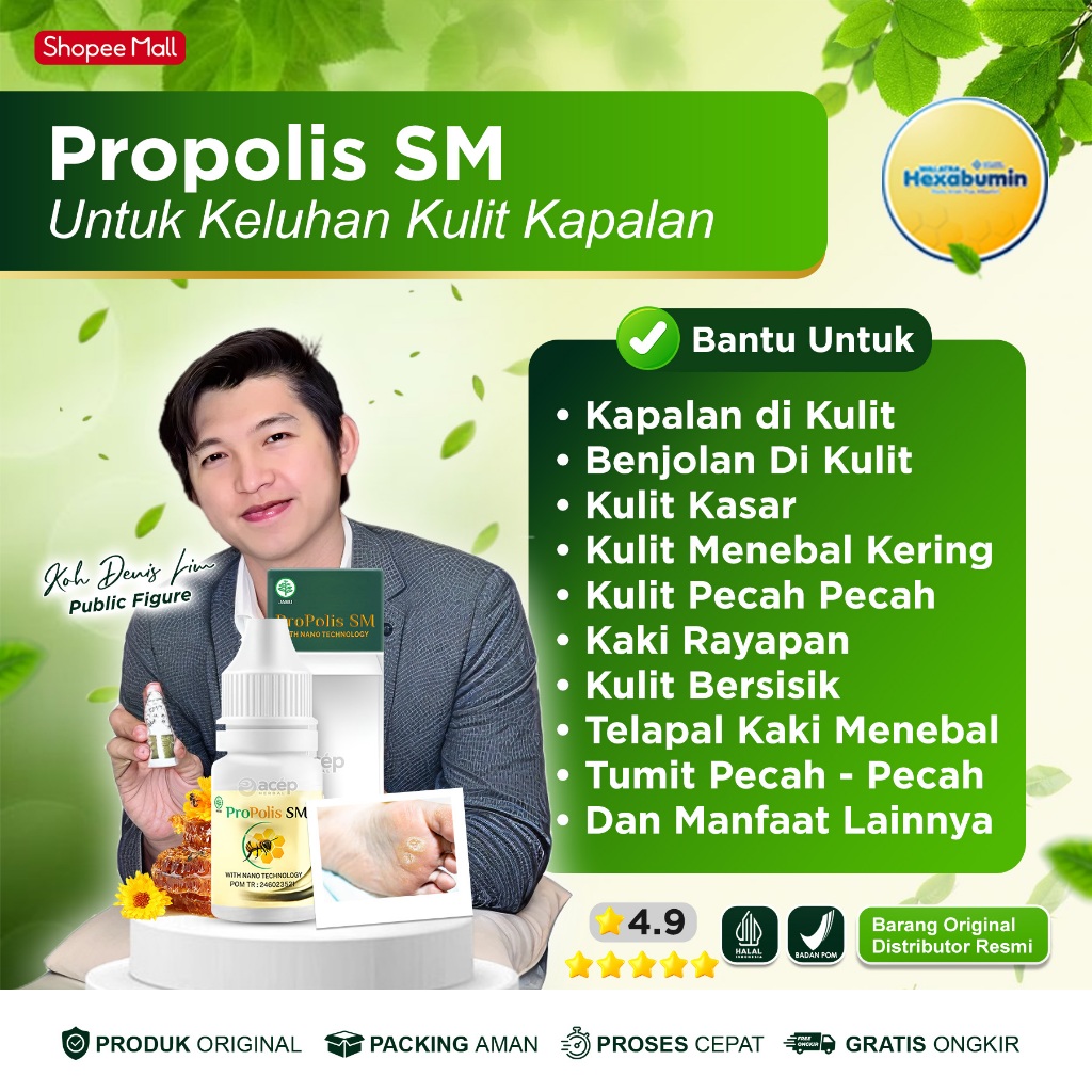 Obat Oles Kapalan Di Kaki Dan Tangan Kaki Rayapan Benjolan Keras Di Kulit Telapak Kaki Kapalan Kulit