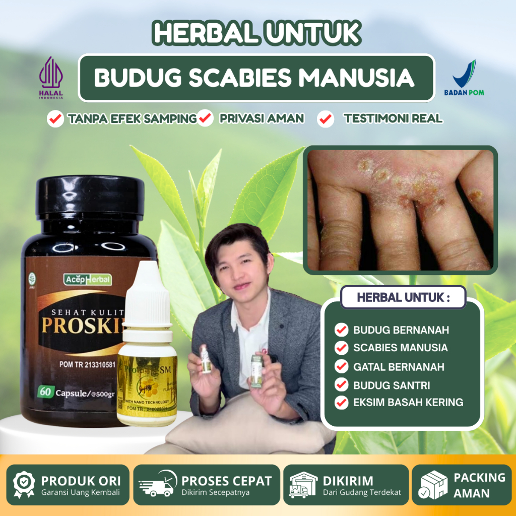 Obat Budug Borok, Gatal Eksim Bernanah, Obat Luka Bernanah, Penghilang Scabies Manusia Gudik Gudig ,