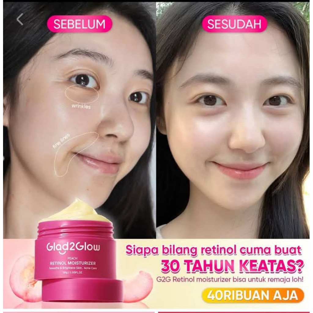 Cream Cordy ceps / yu chun mei import