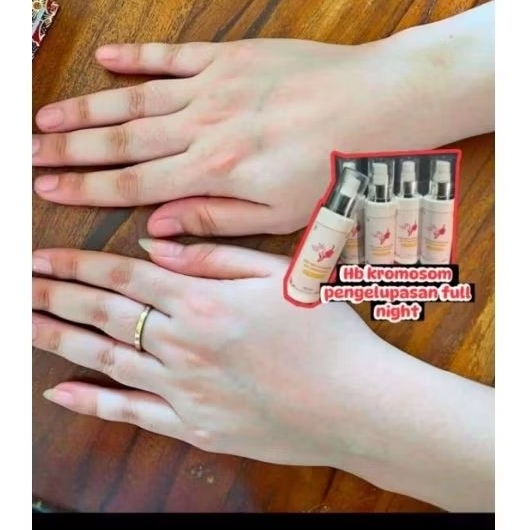 HB PENGELUPASAN KROMOSOM