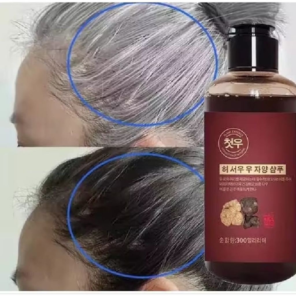 SHAMPOO UBAN PENGHITAM RAMBUT PERMANEN PENGHILANG UBAN GINSENG BLACK HERBAL NATURAL SHAMPOO