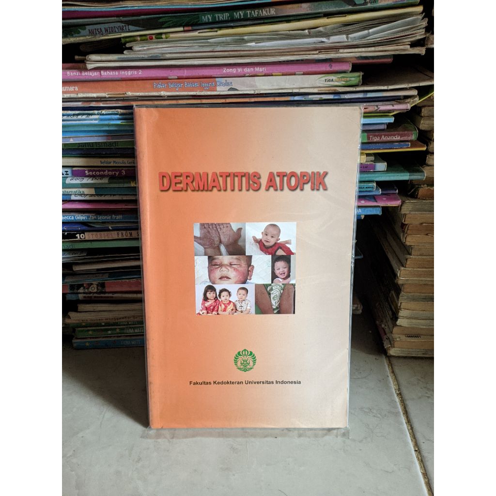 Buku Dermatitis Atopik FKUI