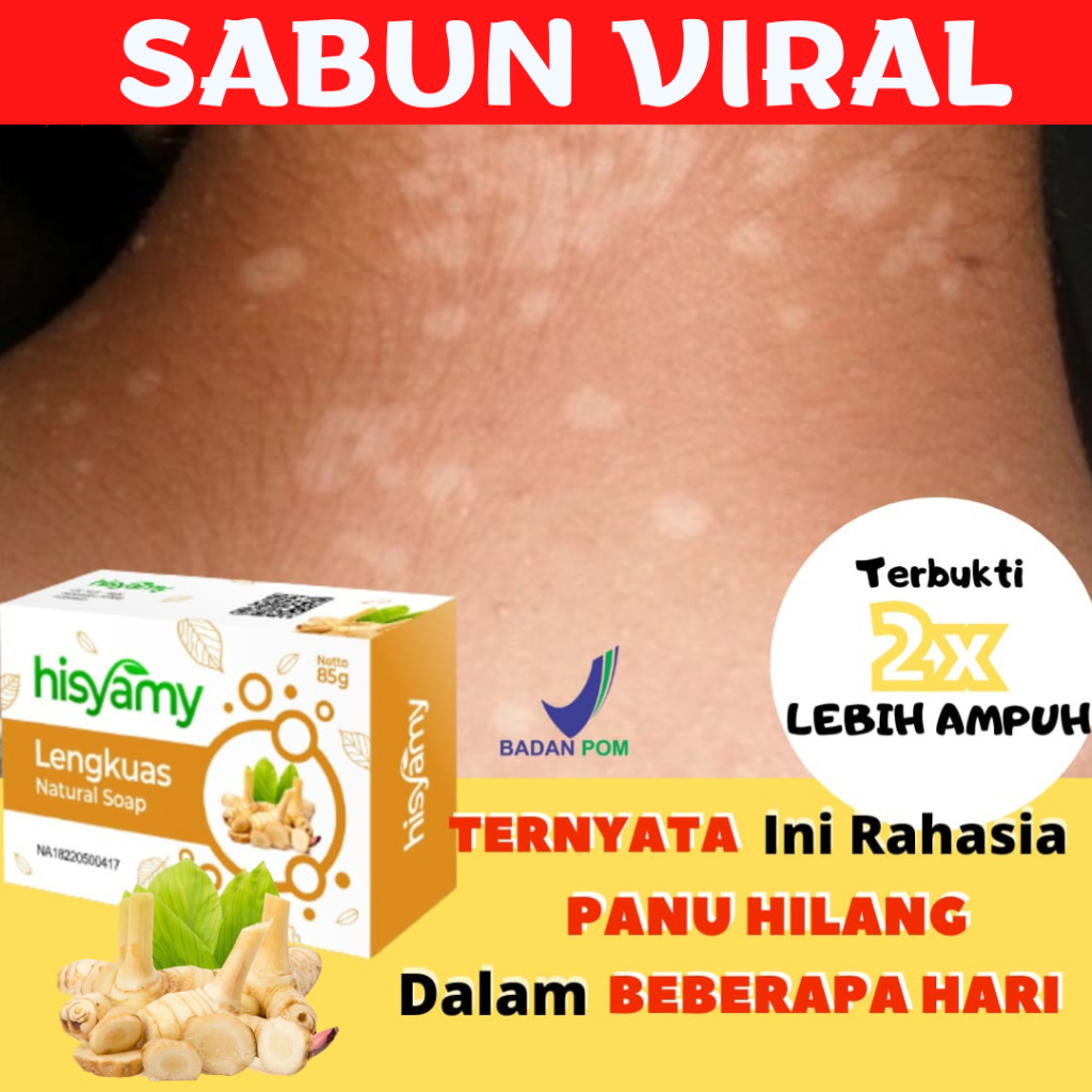 SABUN VIRAL ANTI PANU (COD) Sabun Herbal Lengkuas GROSIR untuk Wajah & Badan Anti Panu Jamur Anti Ja