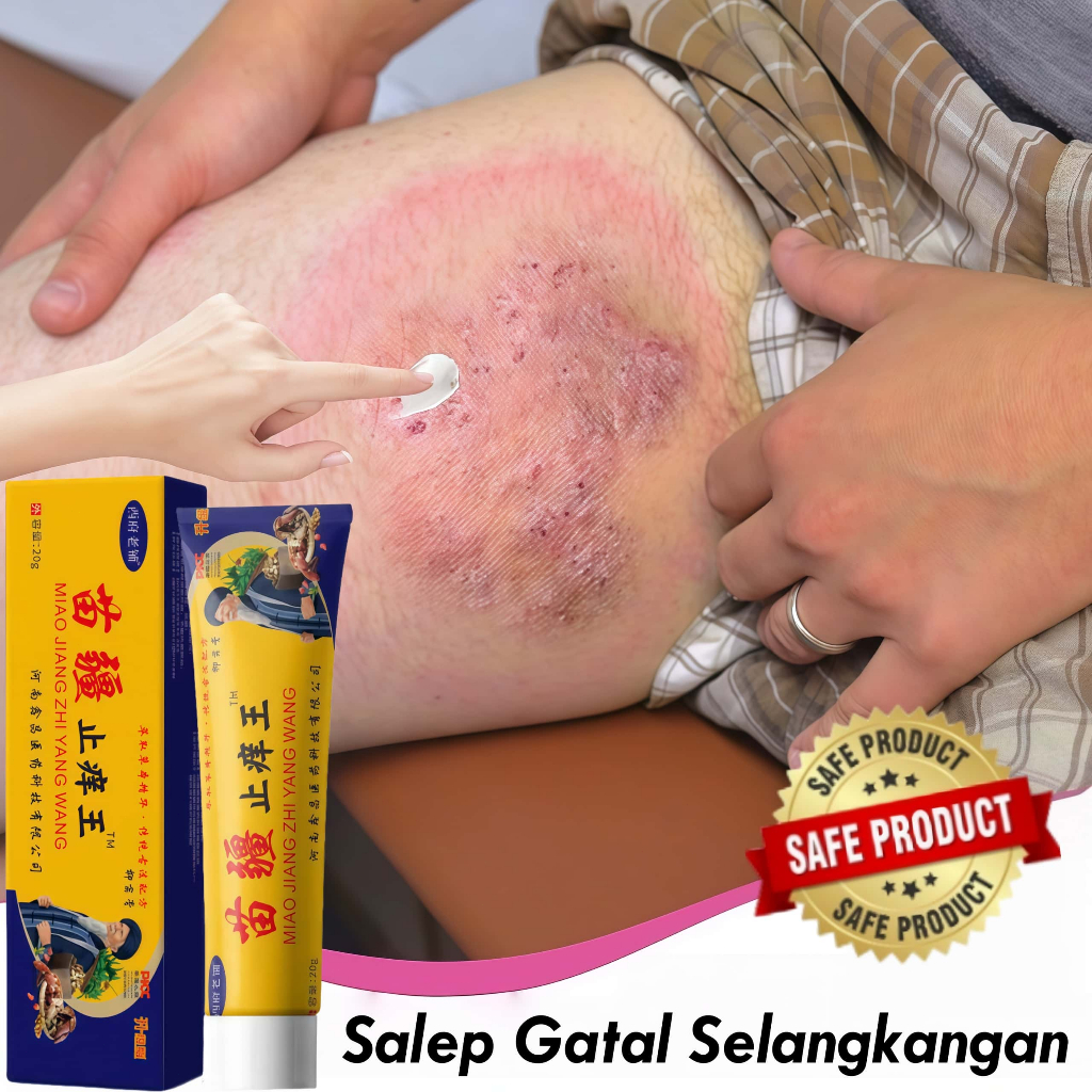 Salep Gatal Selangkangan Krim Gatal Kemaluan Salep Gatal China Paling Ampuh Obat Kurap Salep Gatal E