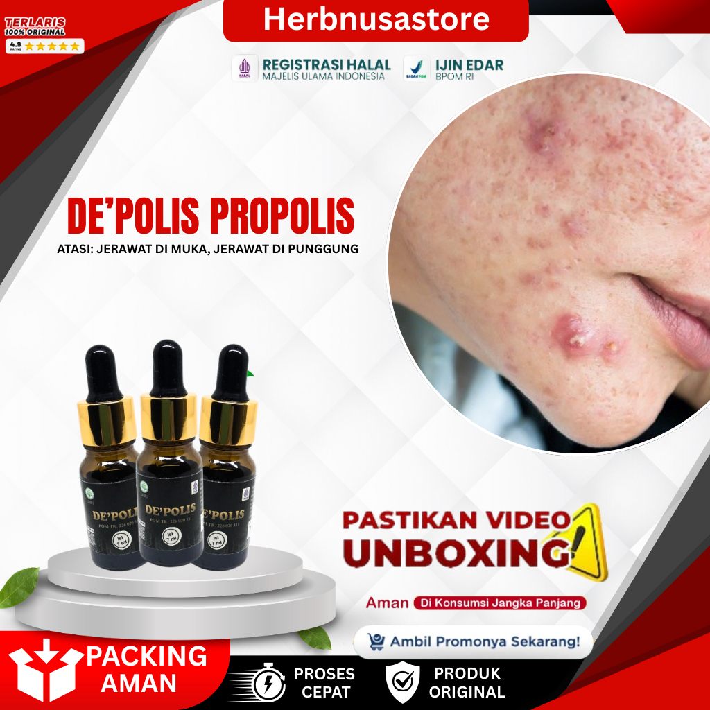 DEPOLIS PROPOLIS Obat Herbal untuk Jerawat Batu dan Jerawat Besar Meradang di Wajah, Punggung, atau 