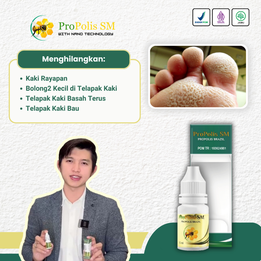 Obat Kaki Rayapan , Obat Penghilang Kaki Rayapan, Telapak Kaki Berlubang Bolong Bolong Kecil, Tumit 