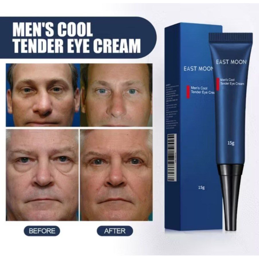 Krim Openeyes Penghilang Kantung mata