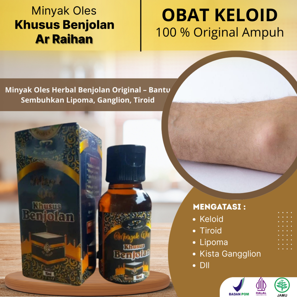 Minyak Oles Herbal Benjolan Original – Bantu Sembuhkan Lipoma, Ganglion, Tiroid