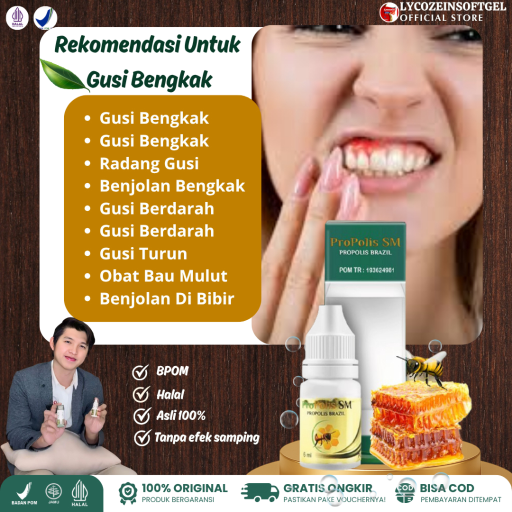 Obat Untuk Gusi Bengkak Benjolan Bengkak Gusi Berdarah Nyeri Gusi Turun Bernanah  Bau Mulut