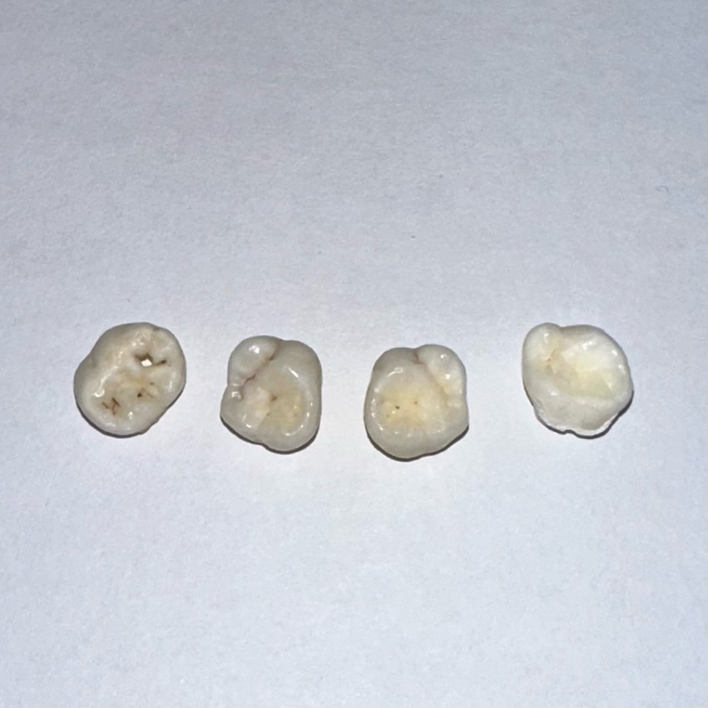 Gigi Molar Desidui Asli Praktikum FKG