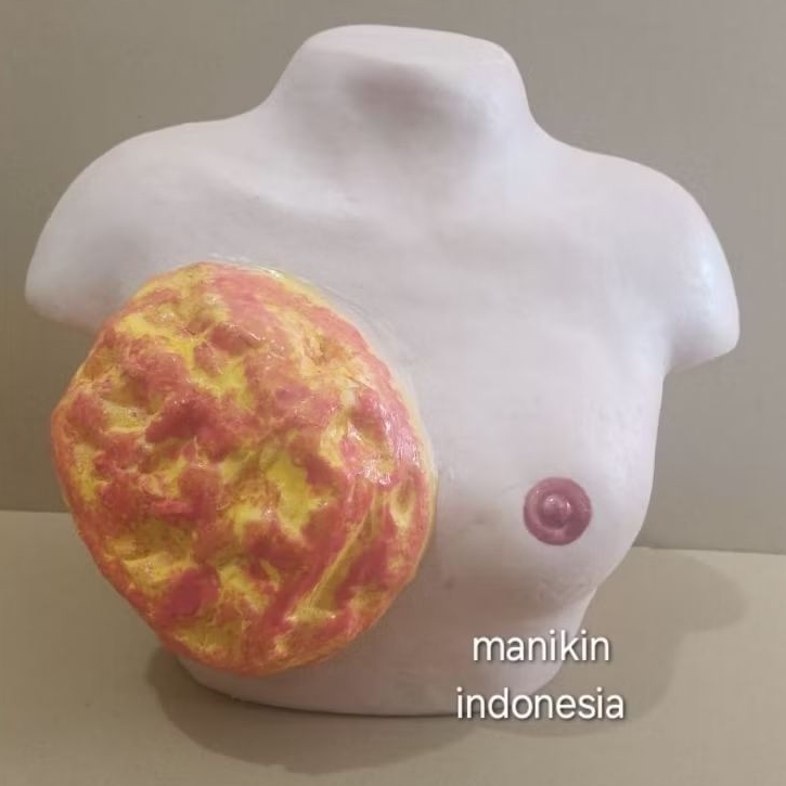 MANIKIN -TUMOR PAYUDARA / PHANTOM MANIKIN TUMOR PAYUDARA / ALAT PERAGA KANKER